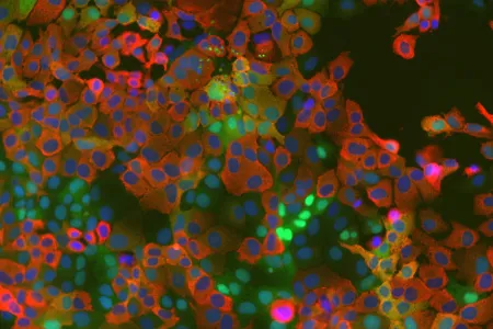 Mikroskopische Aufnahme gefärbter Zellen