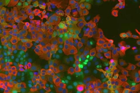 Mikroskopische Aufnahme gefärbter Zellen