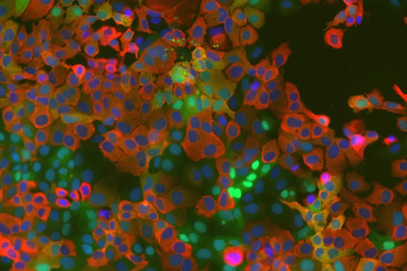 Mikroskopische Aufnahme gefärbter Zellen