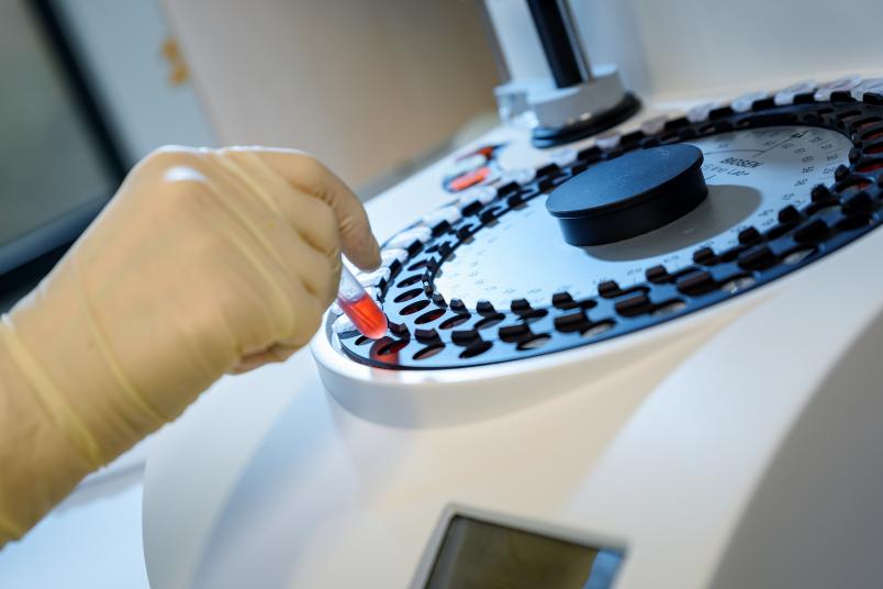 Probe wird in Zentrifuge gestellt