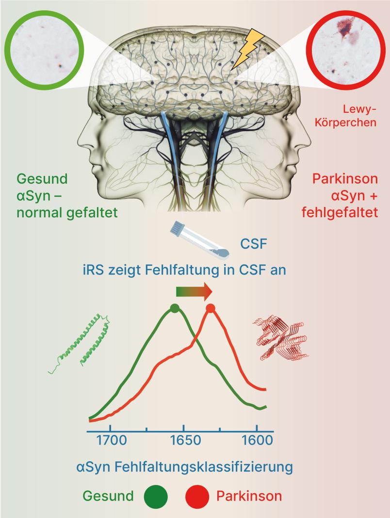 Grafik zweier Gehirne mit gesundem und krankem Gewebe sowie Messkurven