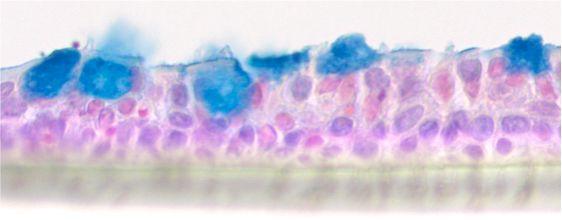 Air liquid interface Kultur von humanen bronchialen Epithelzellen