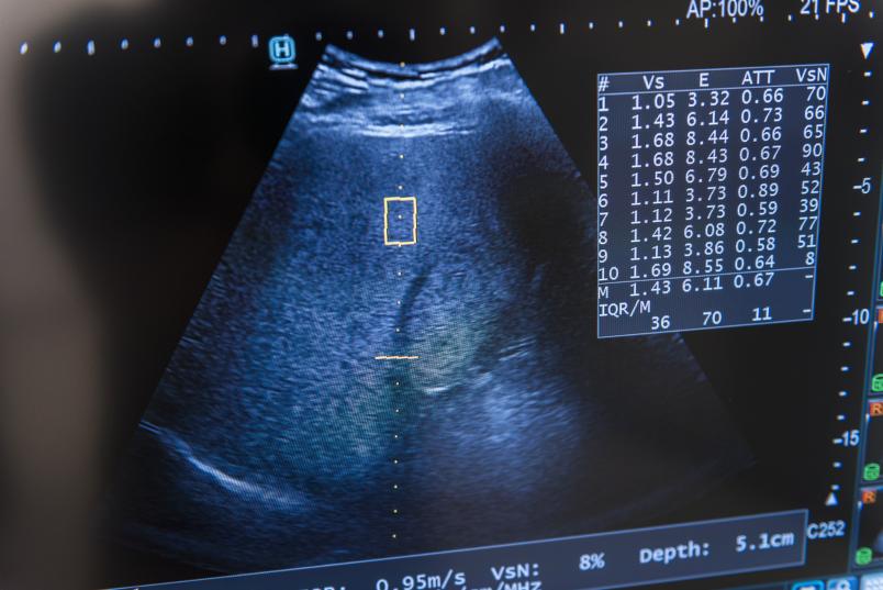 Ultraschallbild