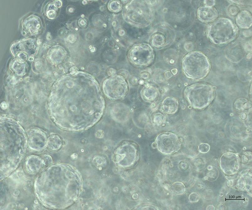 Transparente Bläschen verschiedener Größe füllen das Bild