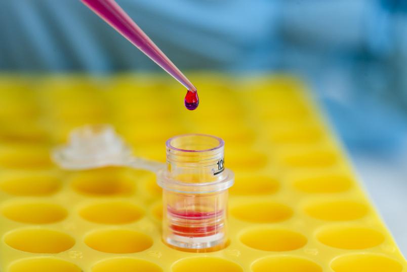 Rote Flüssigkeit tropft aus Pipette