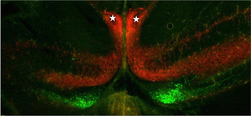 Mikroskopische Aufnahme Hippocampus