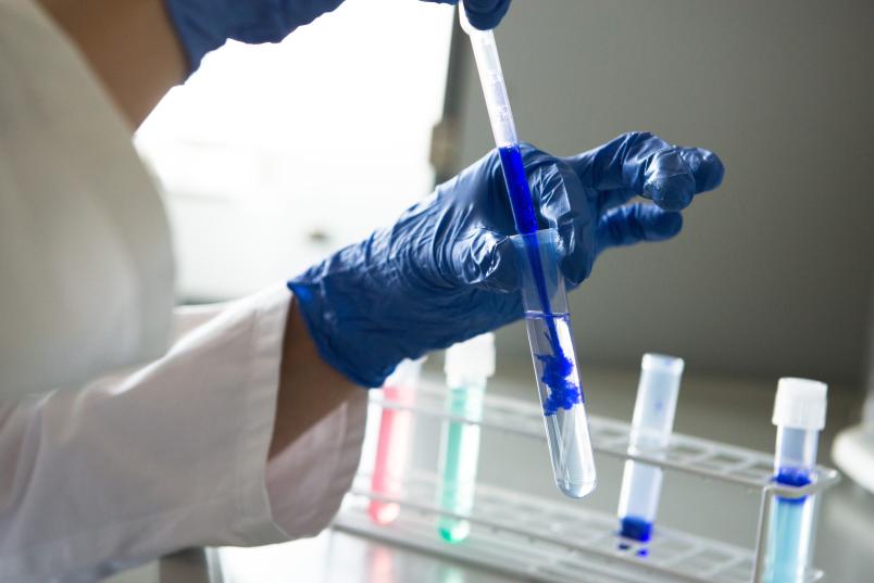 Eine Person spritzt mit einer Pipette blaue Flüssigkeit in eine durchsichtige Flüssigkeit im Reagenzglas.