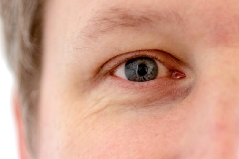 Auge