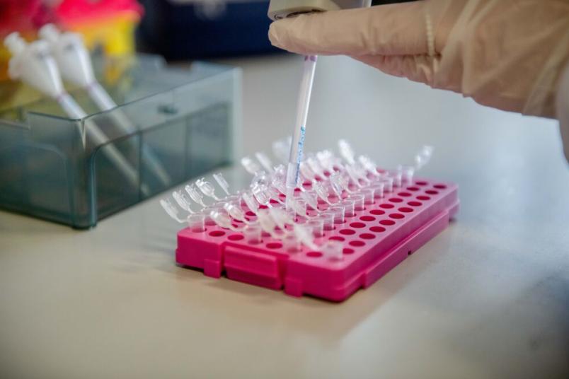 Eine rosa Halterung mit winzigen Gefäßen, die mit einer Pipette befüllt werden