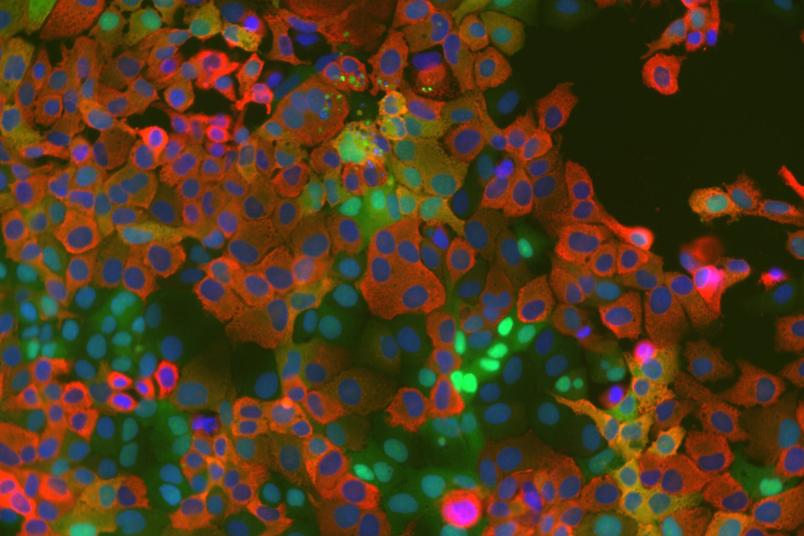 Mikroskopische Aufnahme gefärbter Zellen