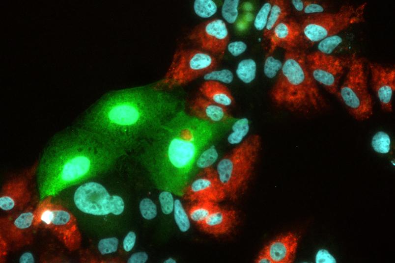 
	Replikation von Hepatitis C virus (HCV) und Hepatitis E Virus (HEV) in humanen Leberzellen. HCV leuchtet bei erfolgreicher Vermehrung rot, HEV grün.
