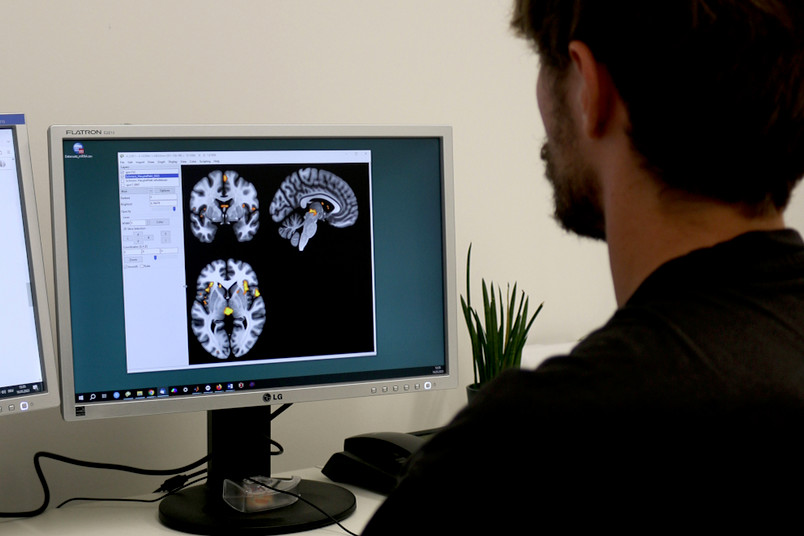 Blick auf einen Monitor mit Gehirnscans