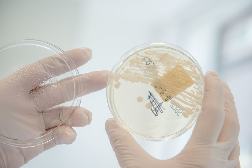 Petrischale mit Bakterienkultur
