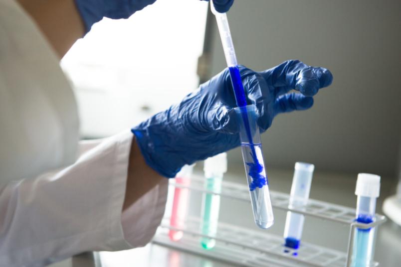 Eine Person spritzt mit einer Pipette blaue Flüssigkeit in eine durchsichtige Flüssigkeit im Reagenzglas.