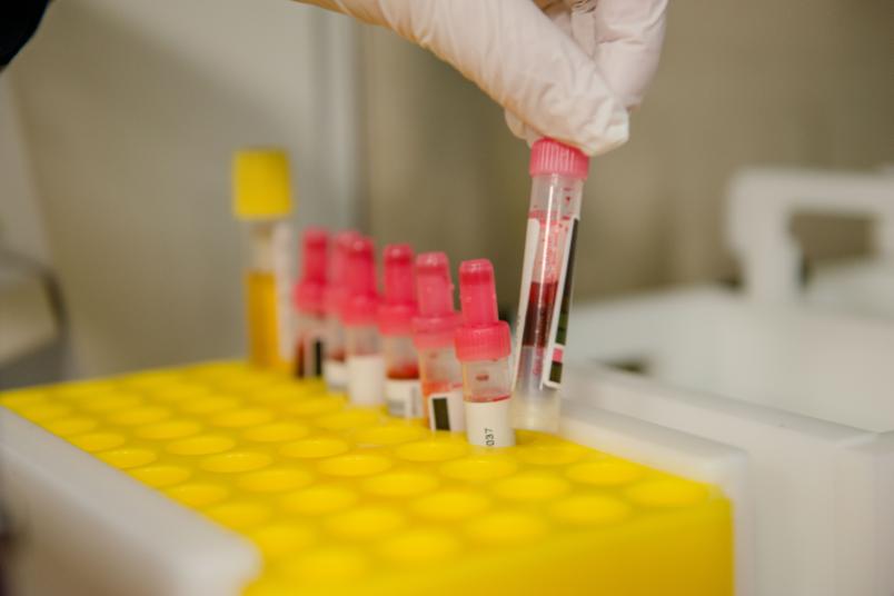 Symbolbild für Forschung und Diagnostik in der Medizin - hier aus der Neuropsychologie