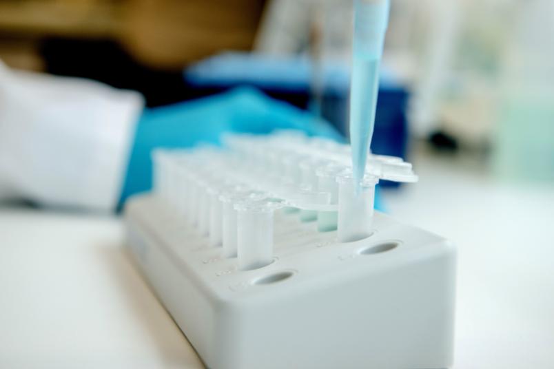 Pipette