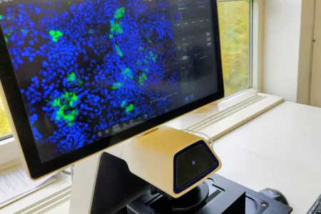 Blick auf einen Computermonitor mit blauen und grünen Zellen